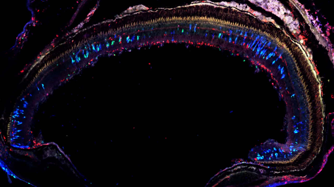 Retina